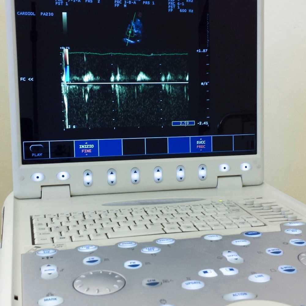 ecocardiograma-mobimagem (2)