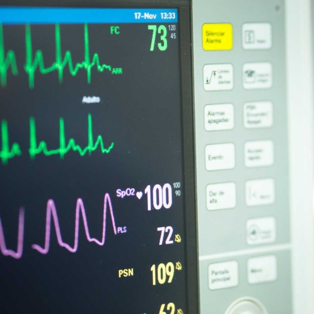 eletrocardiograma-mobimagem (1)