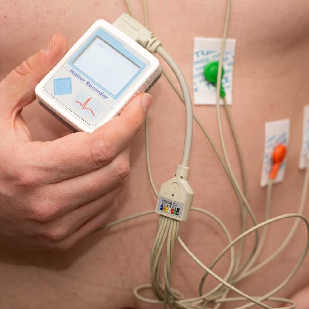 holter-mobimagem (3)