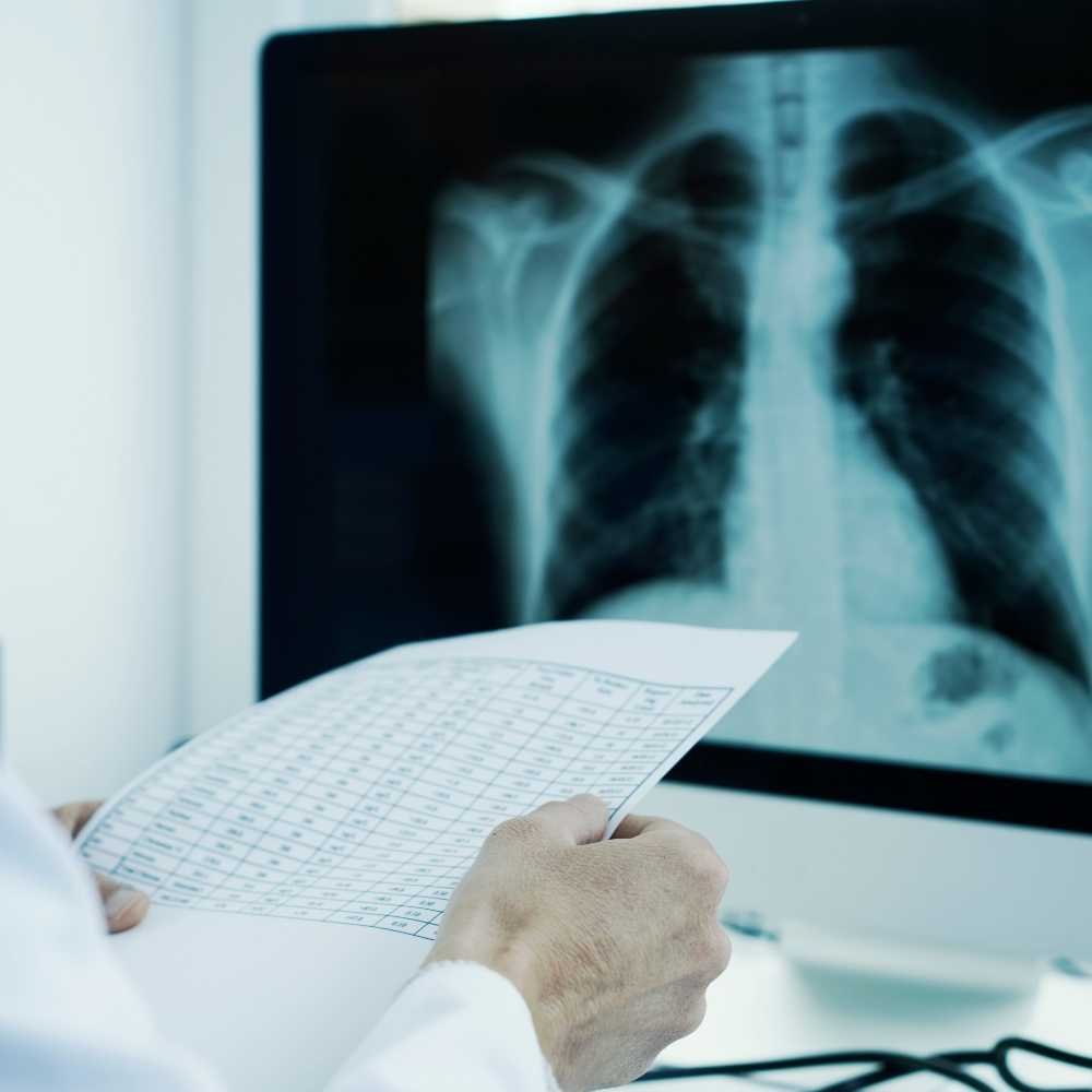 radiografia-mobimagem (1)