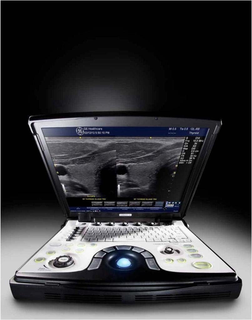 eco-usg-mobimagem-equipamento (1)