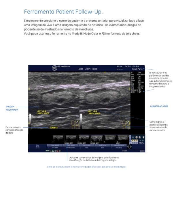 eco-usg-mobimagem-equipamento (7)